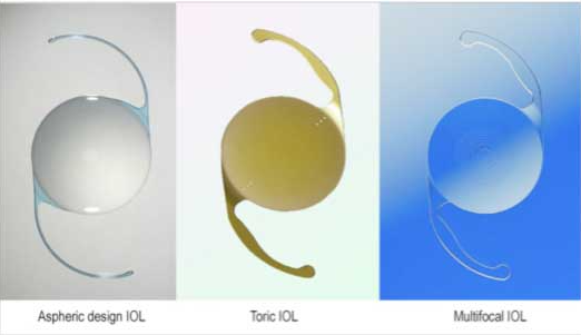 IOL Types